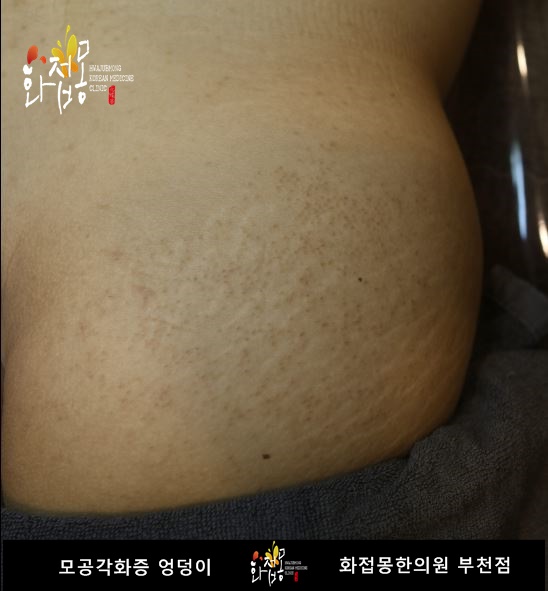 전후사진