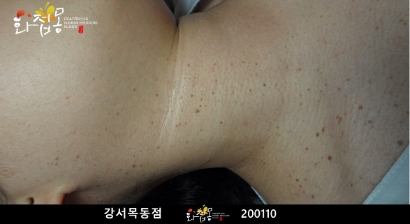 전후사진