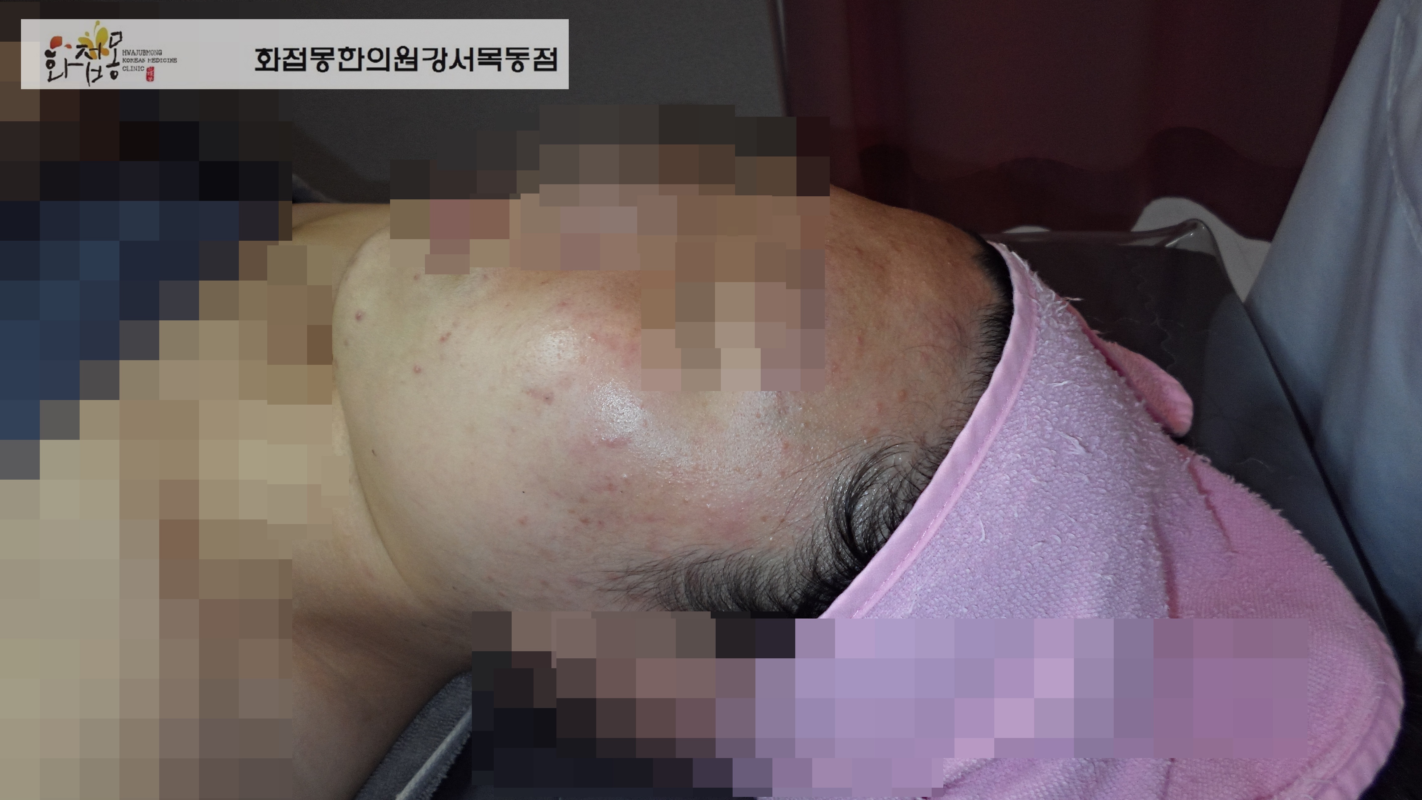 전후사진