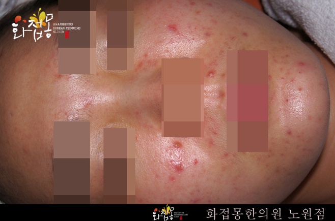 전후사진