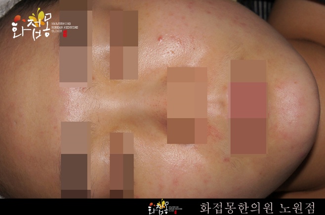 전후사진