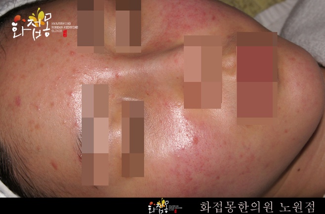 전후사진