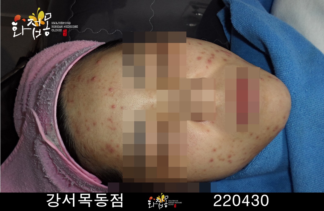 전후사진