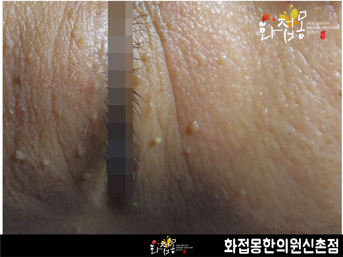 전후사진