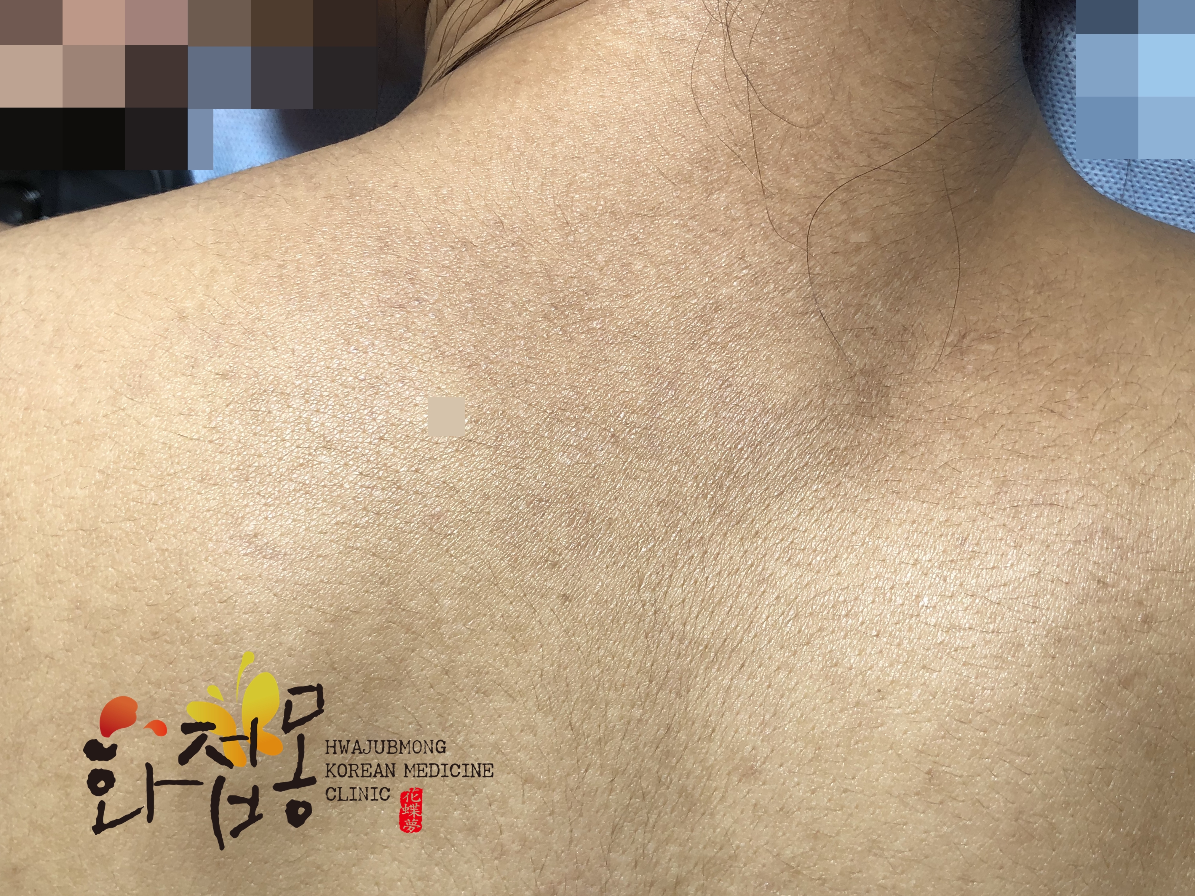 전후사진