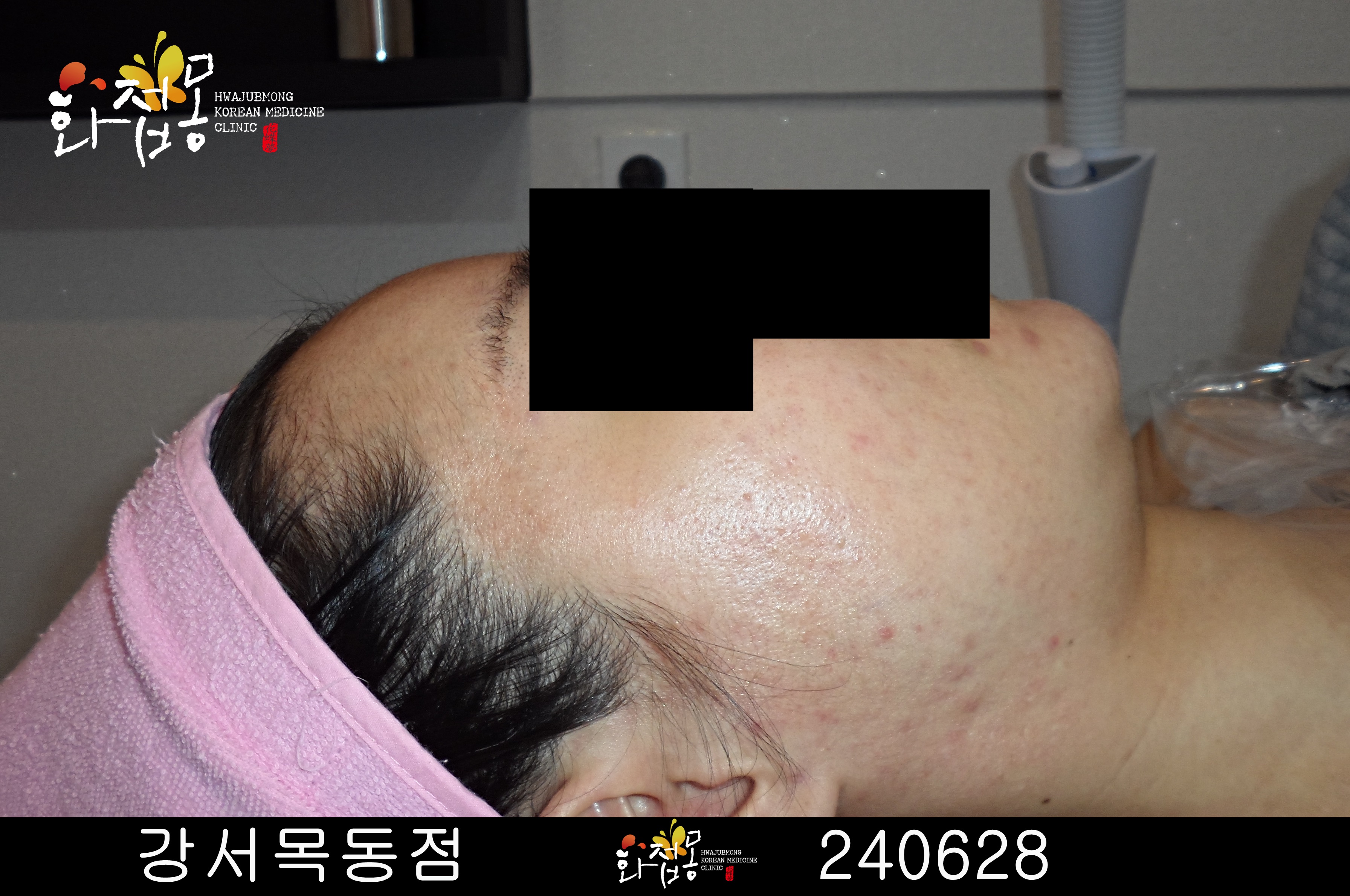 전후사진
