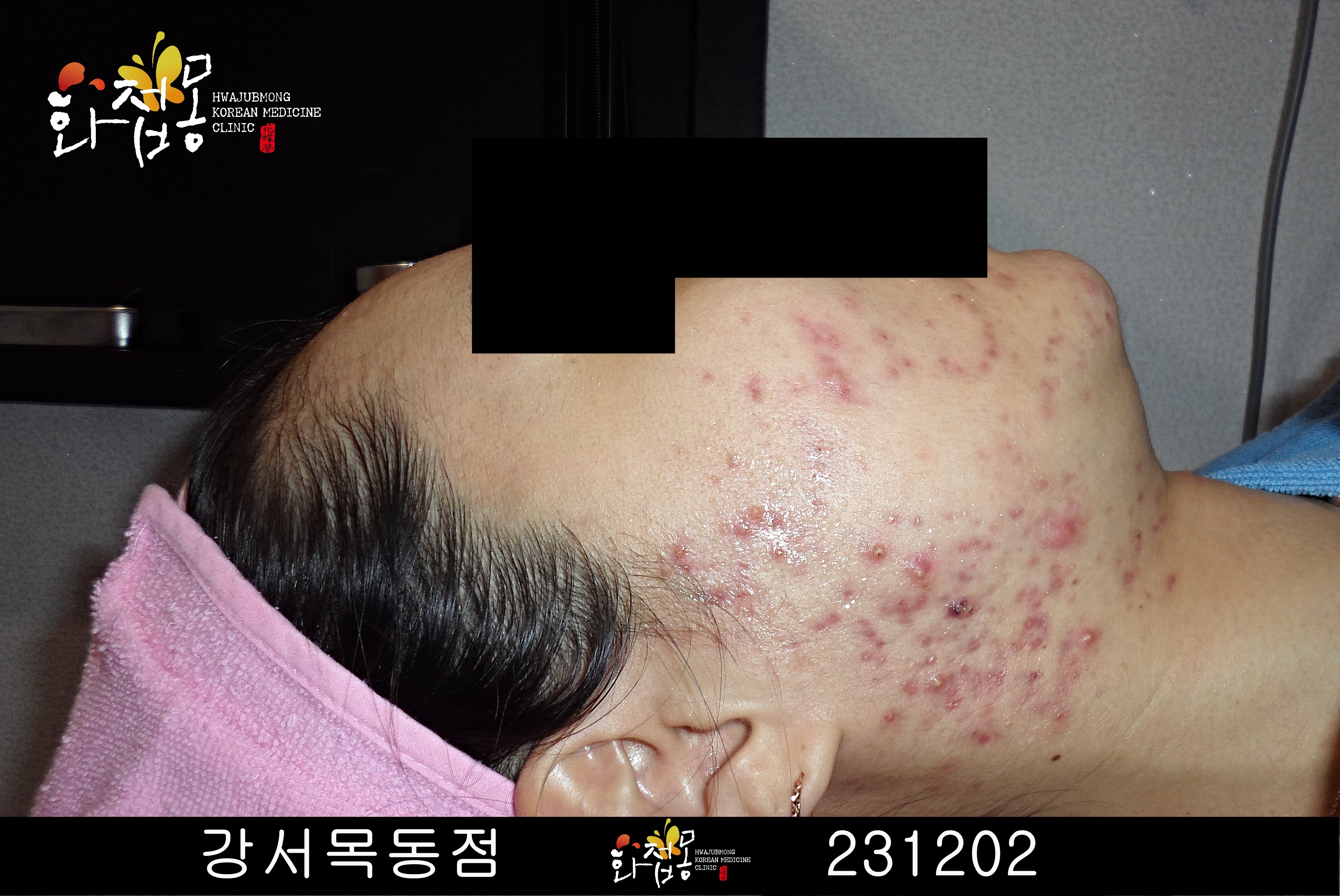 전후사진