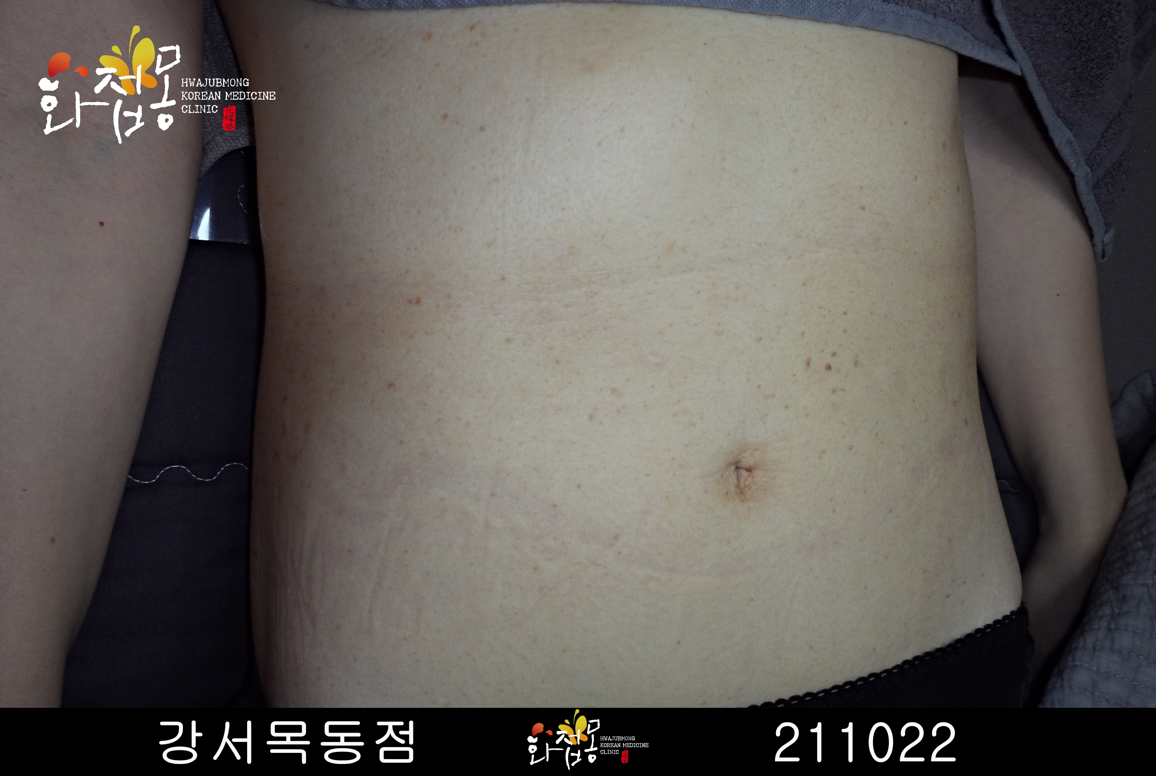 전후사진