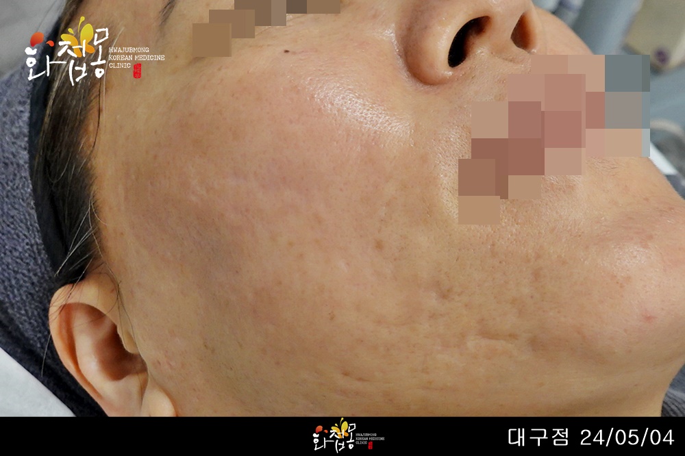 전후사진