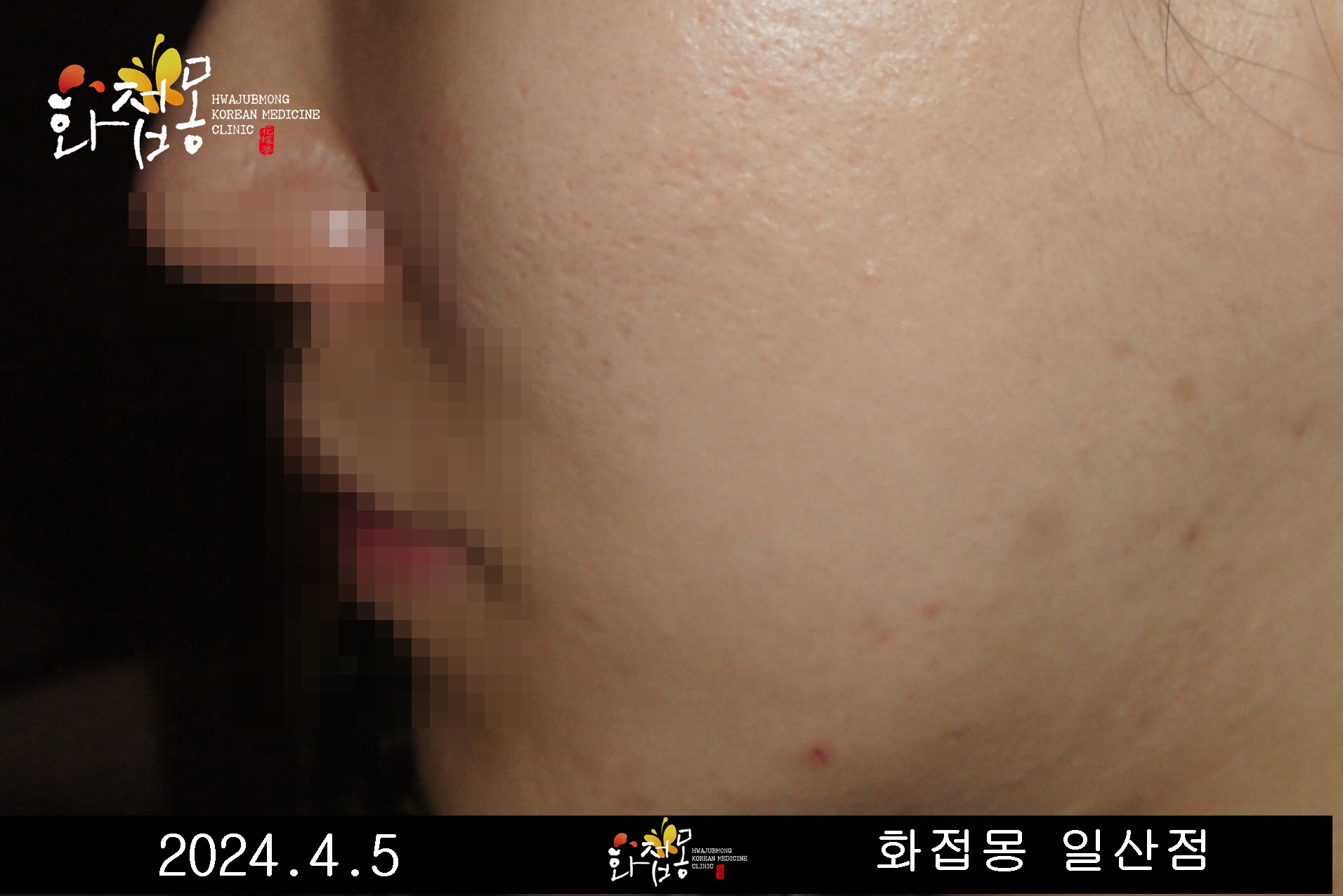 전후사진