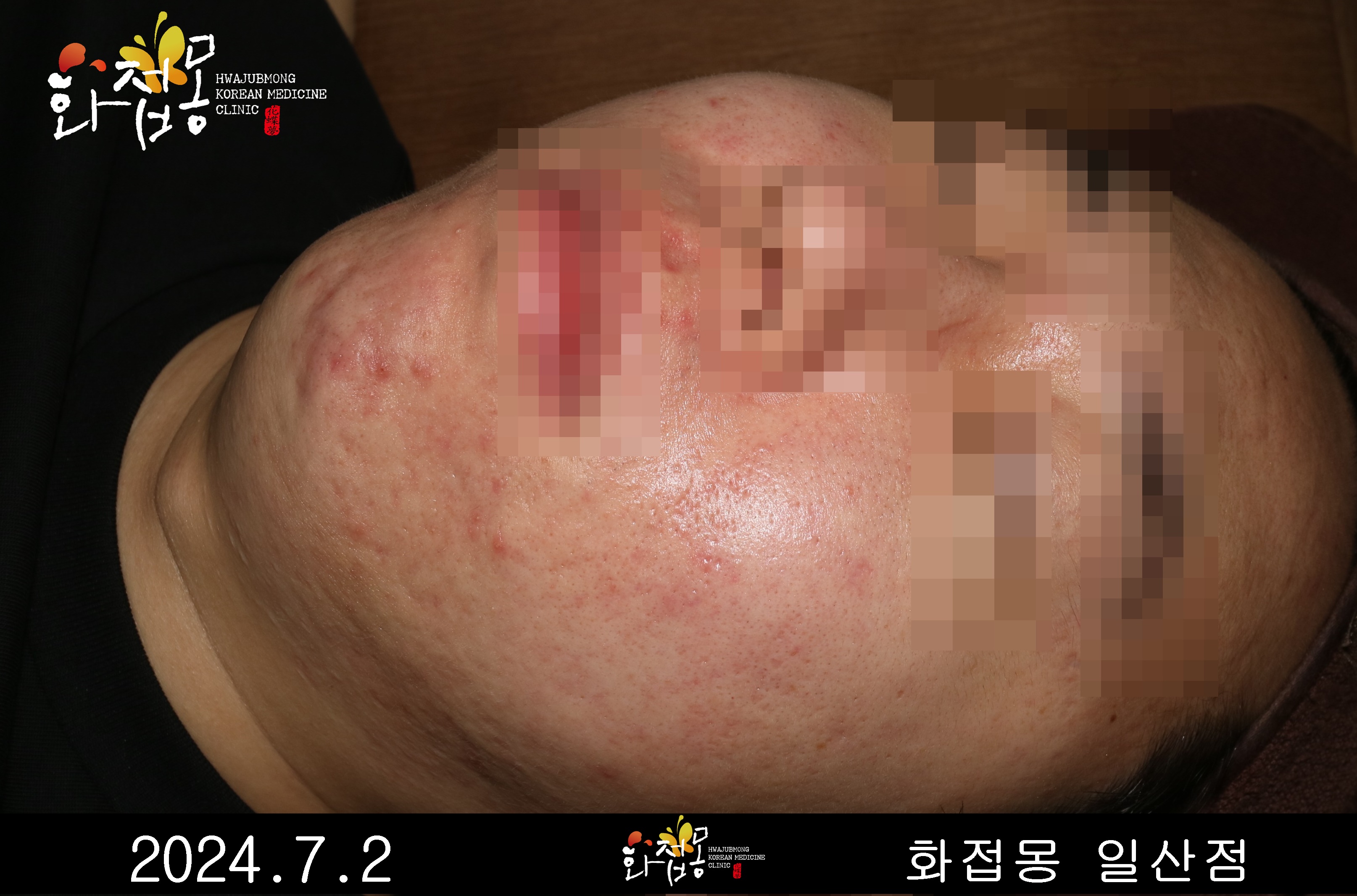 전후사진