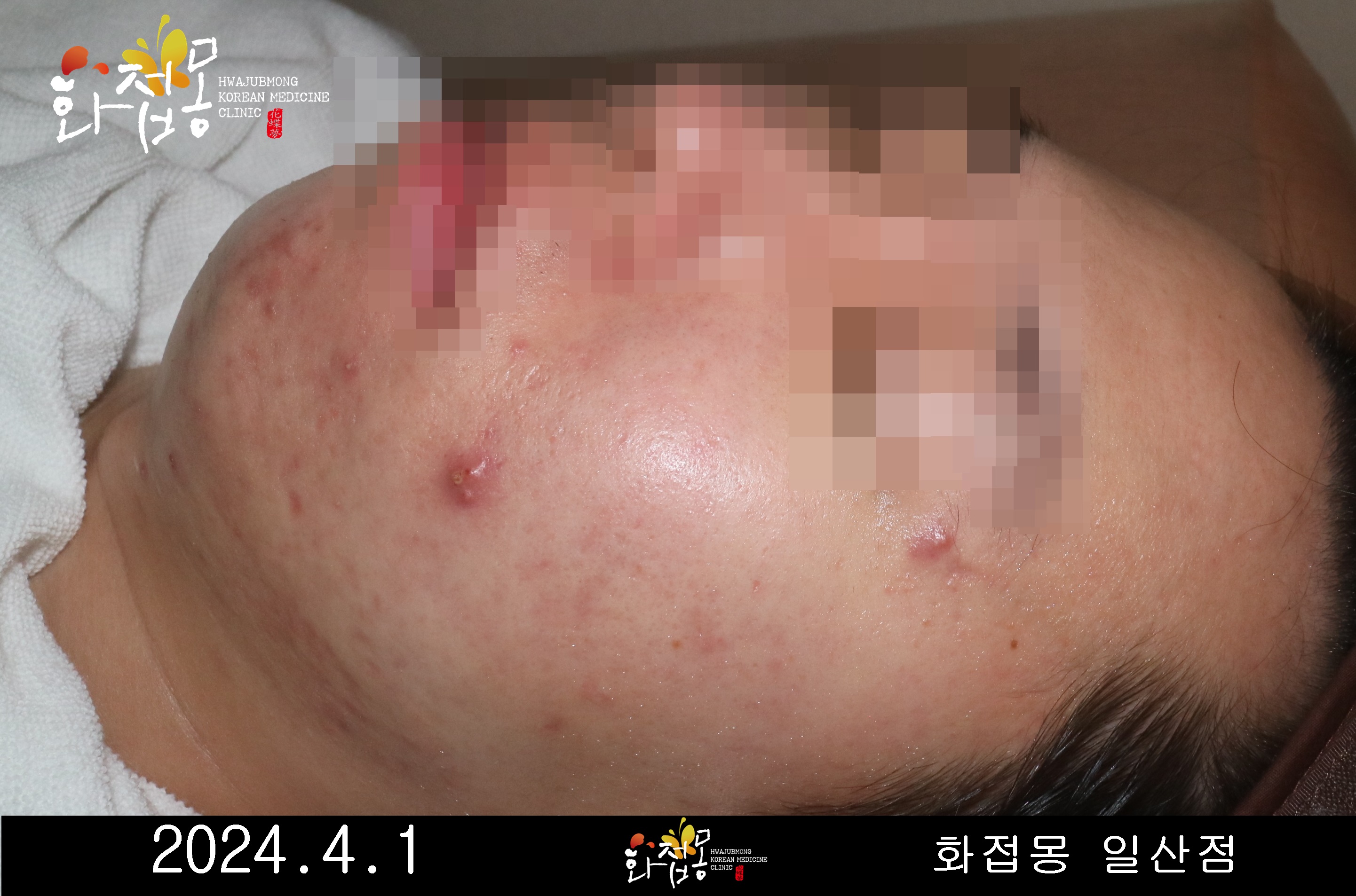 전후사진