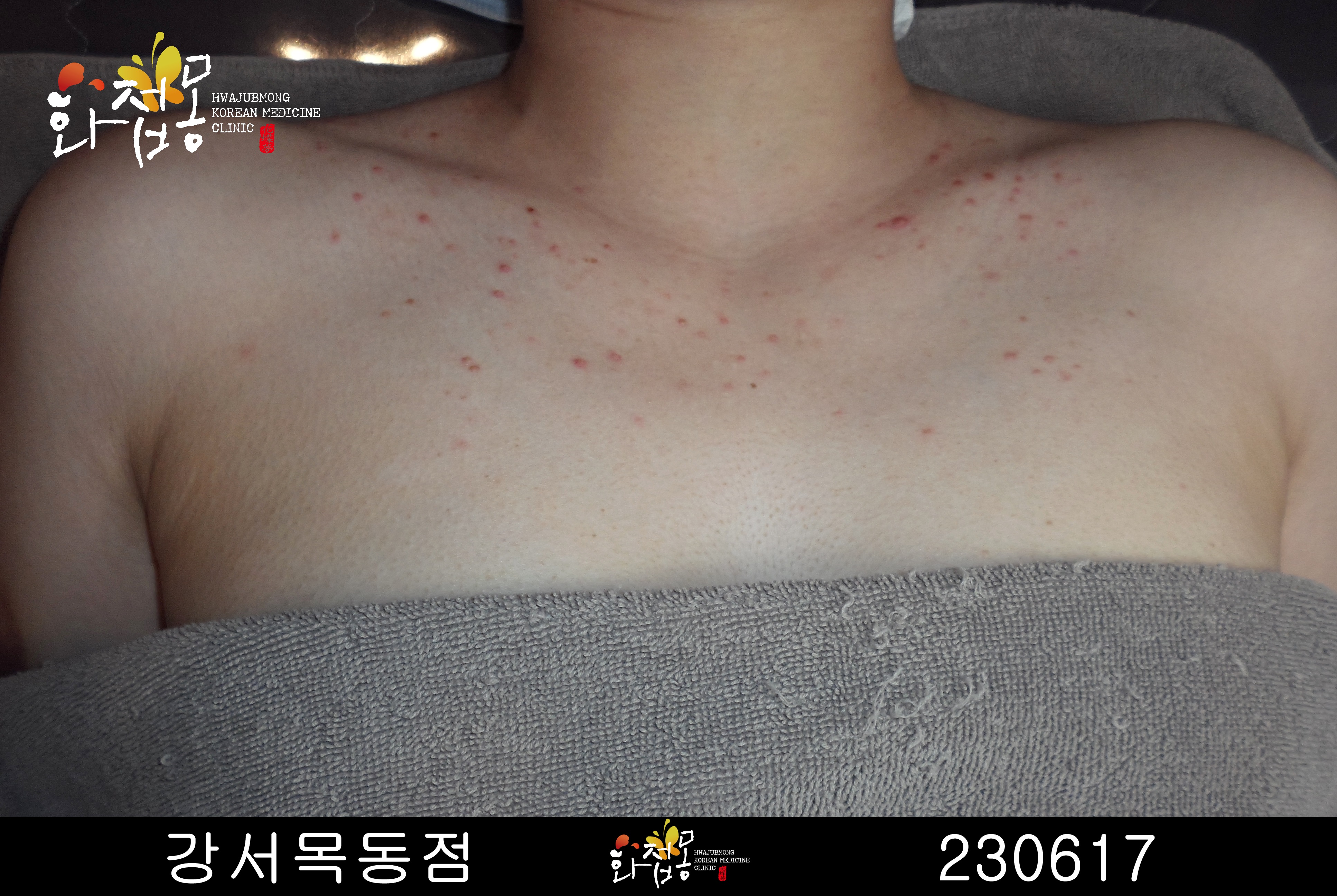 전후사진