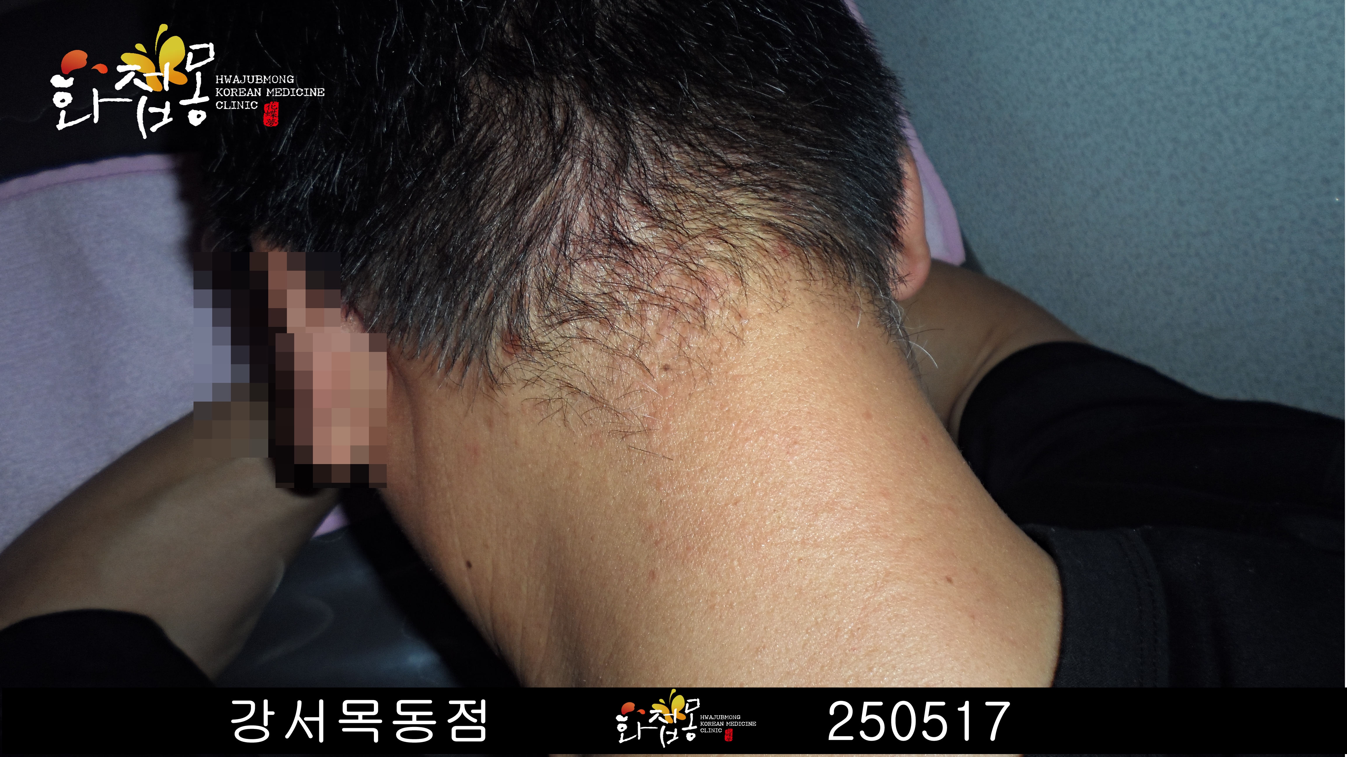 전후사진