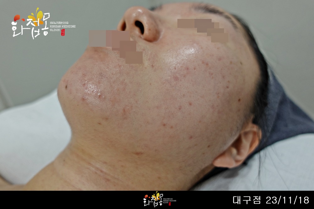 전후사진