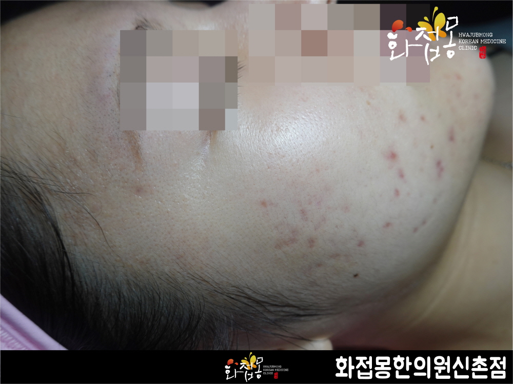 전후사진