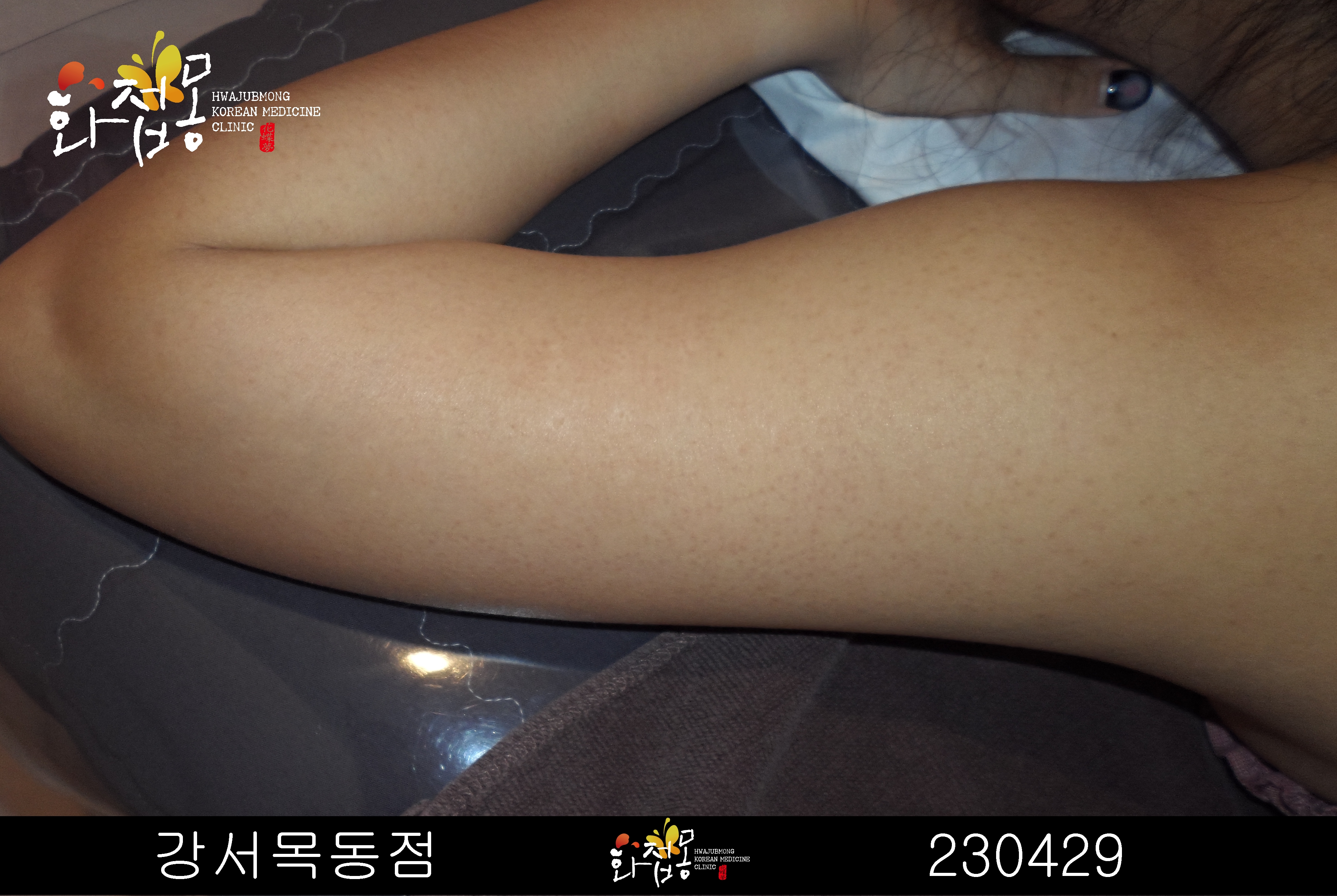 전후사진