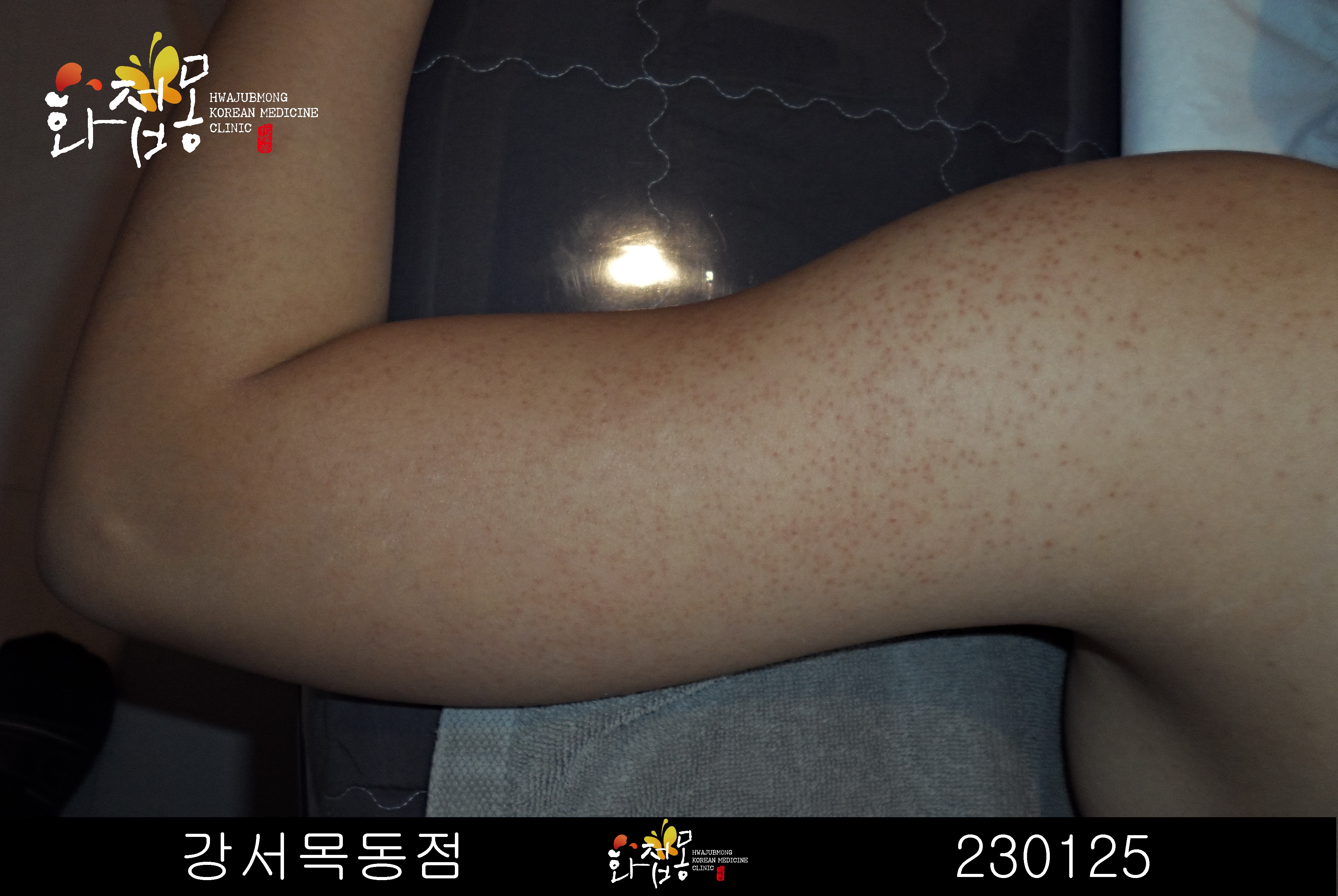 전후사진