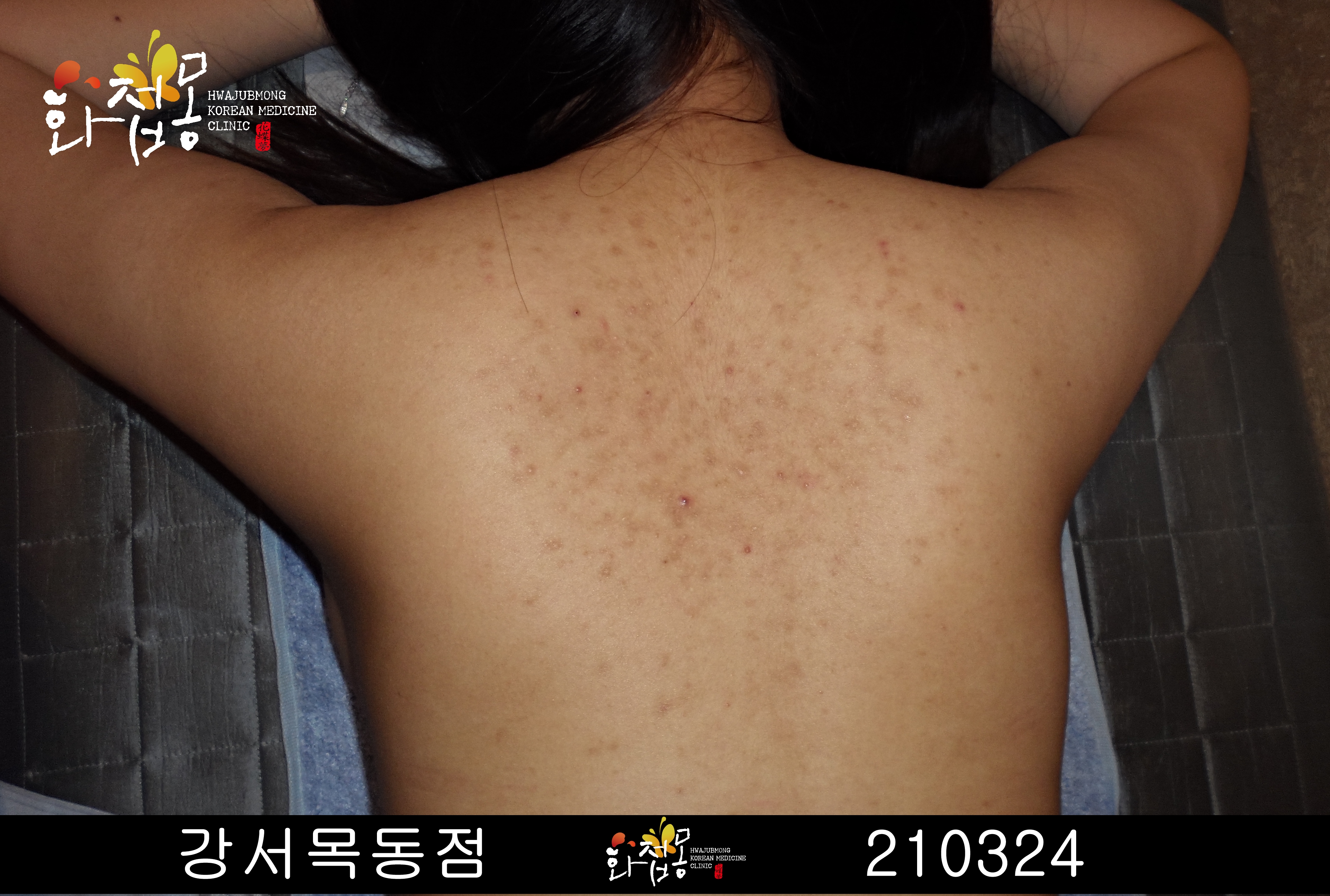 전후사진