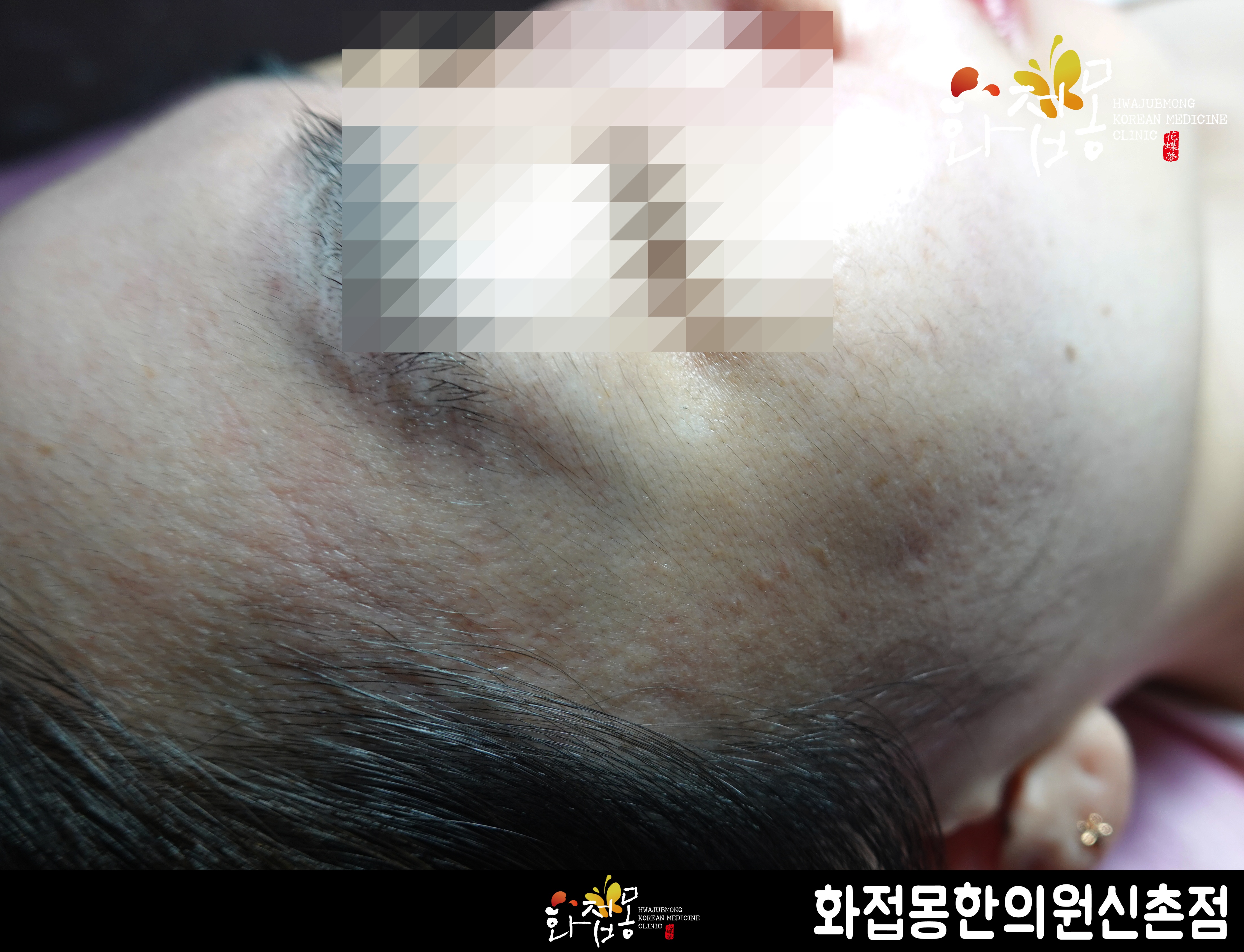 전후사진
