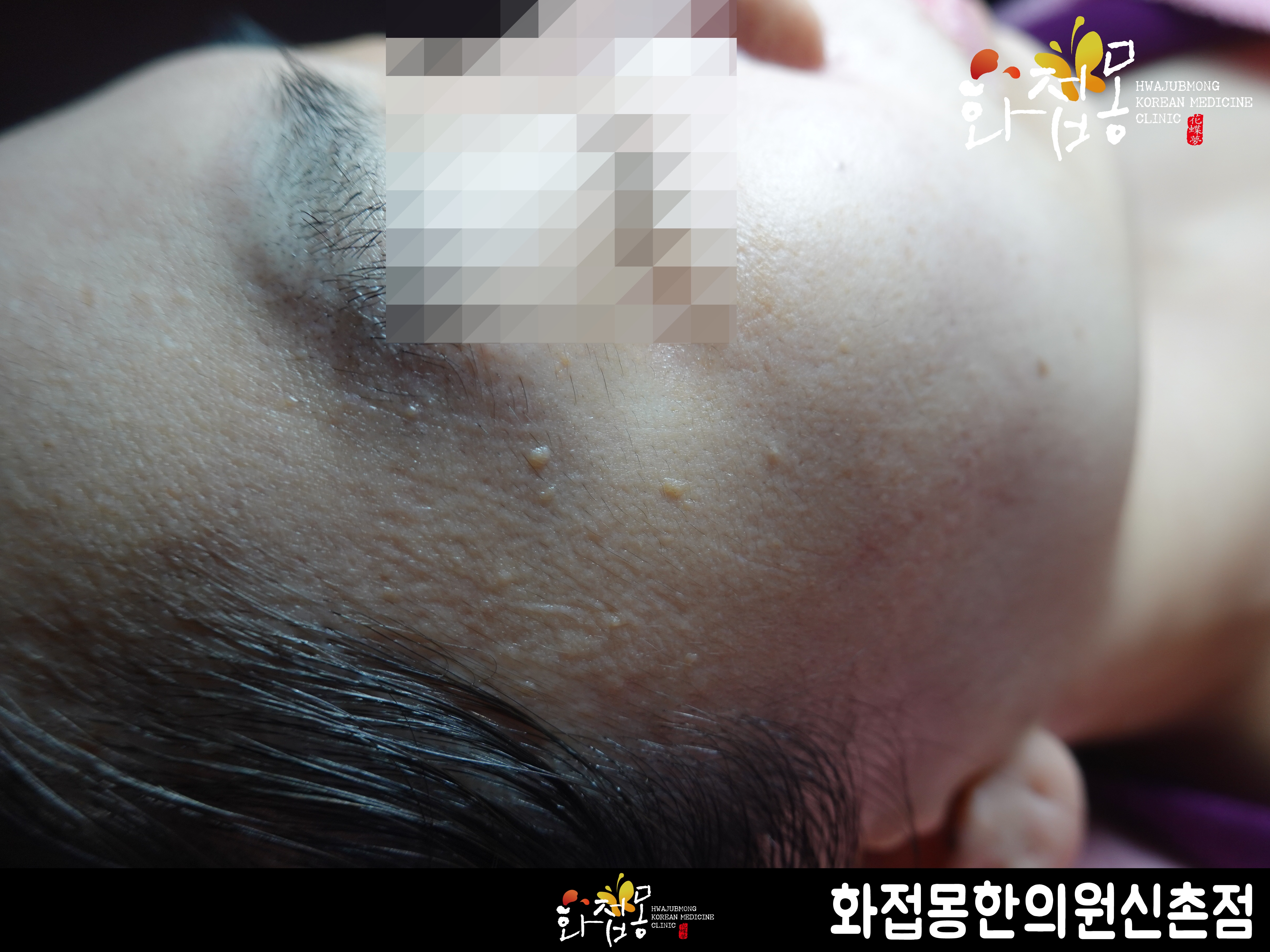 전후사진