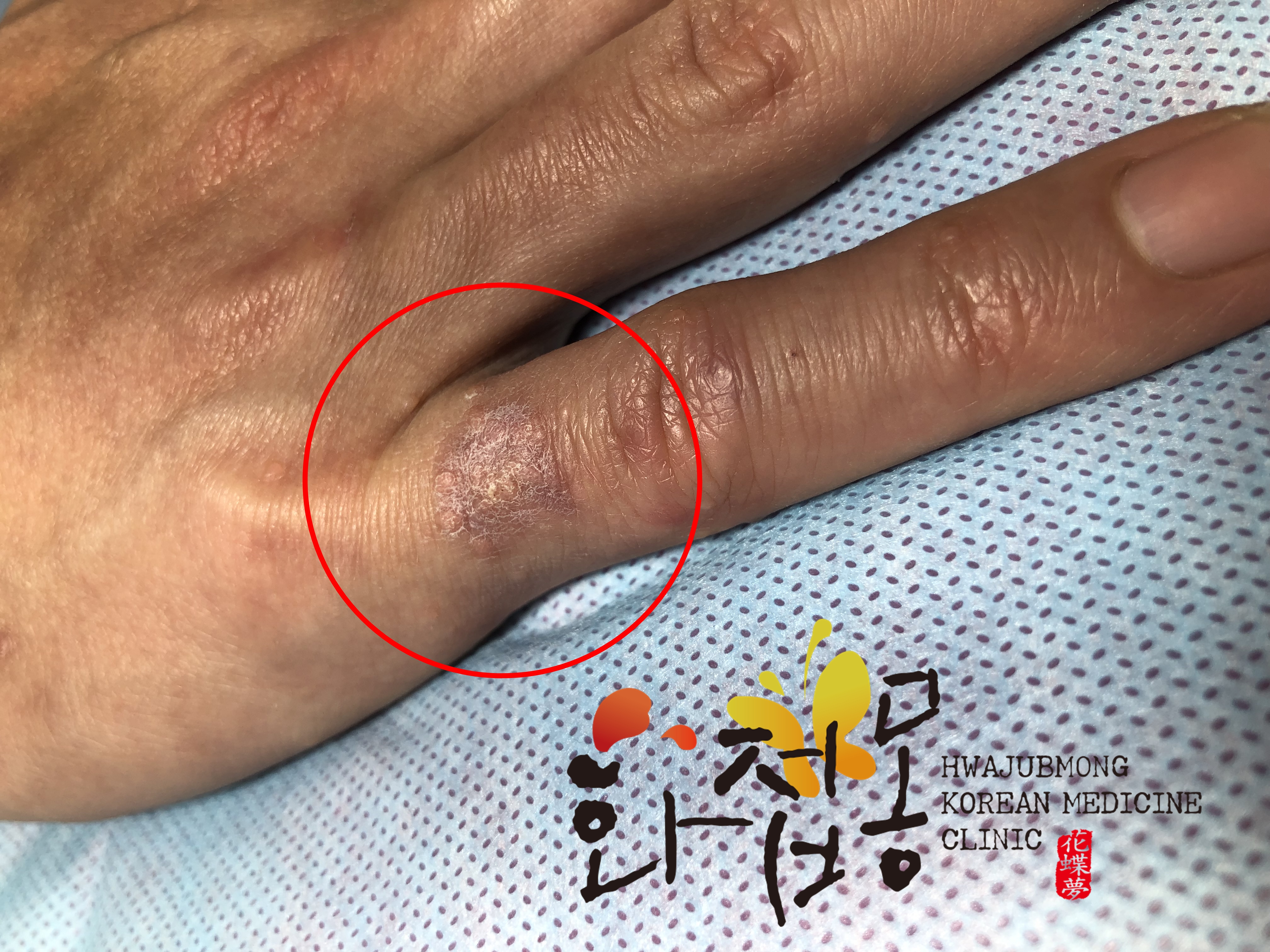 전후사진