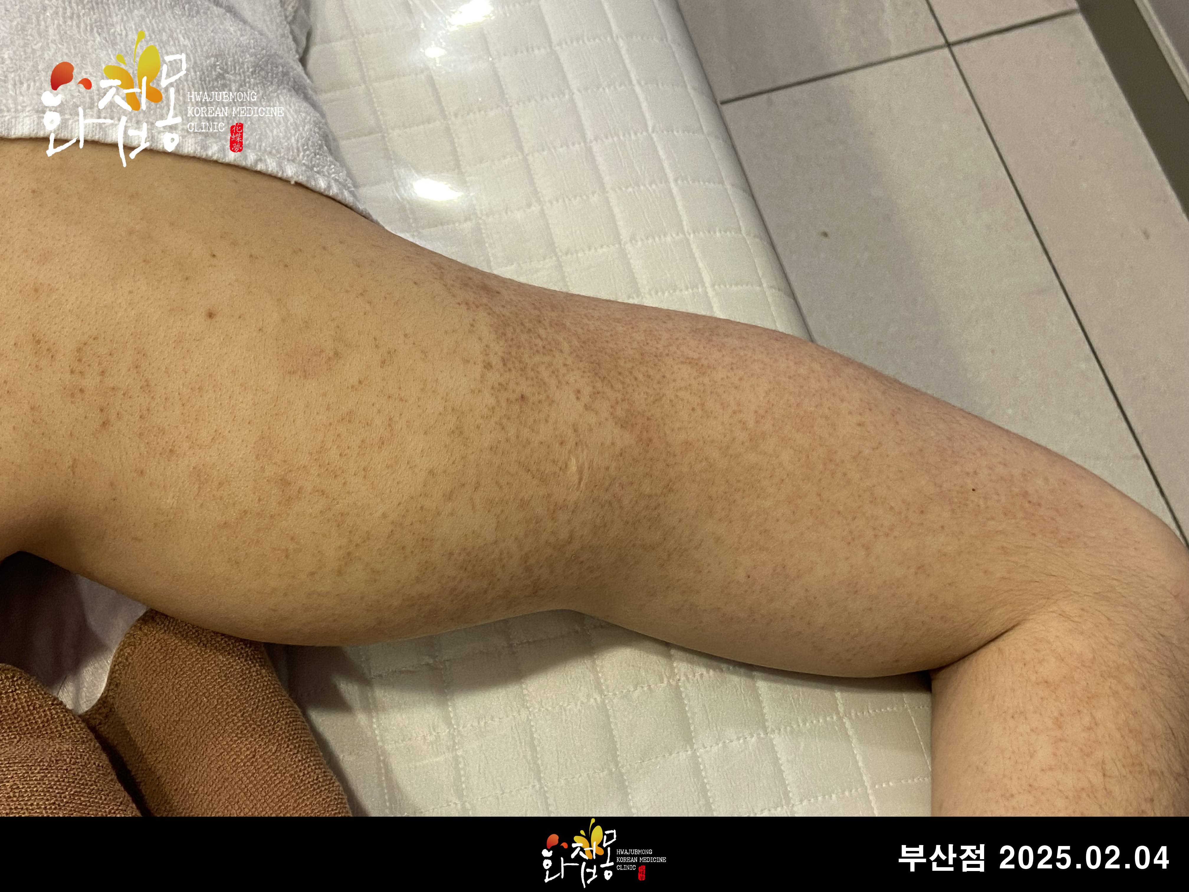 전후사진