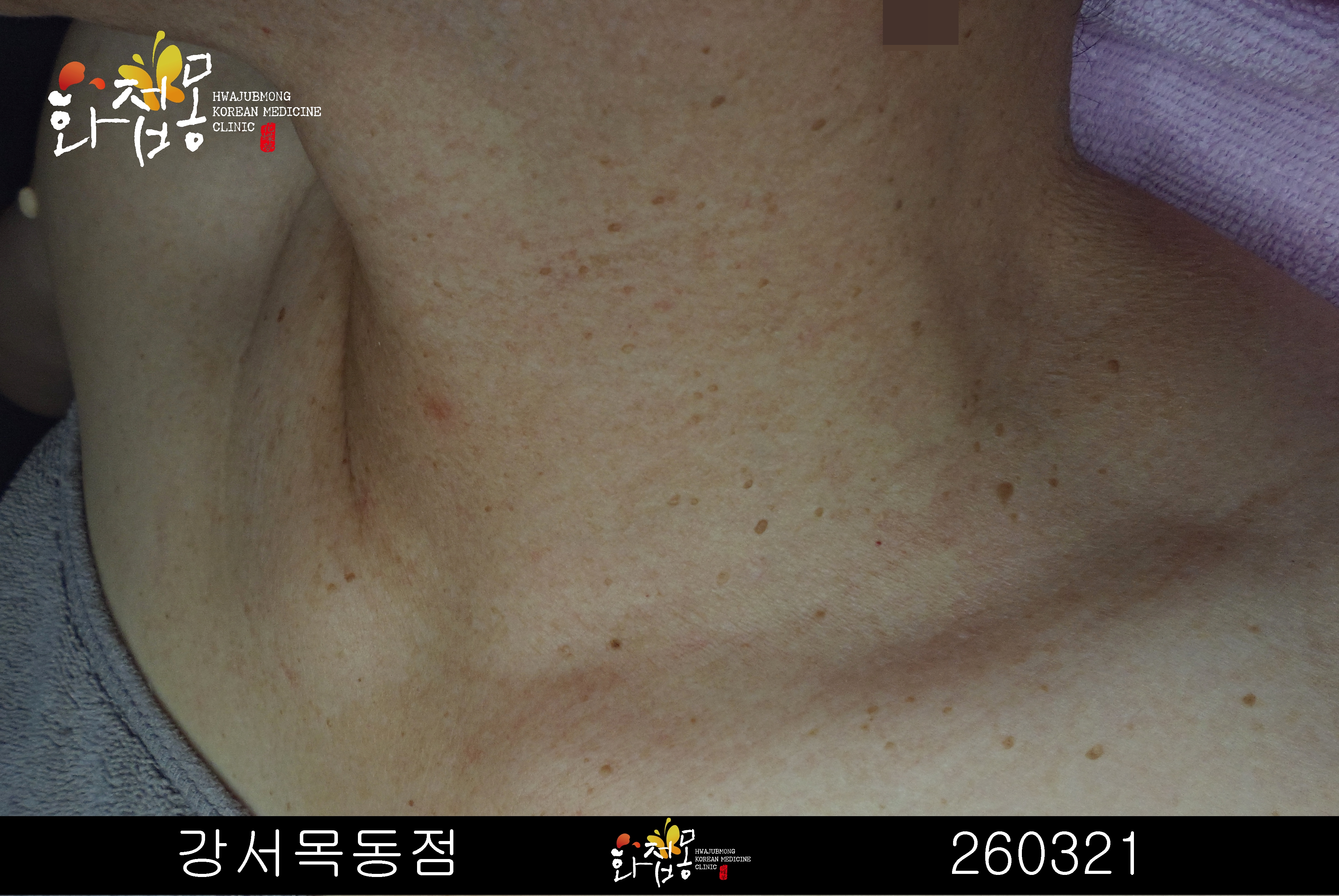 전후사진