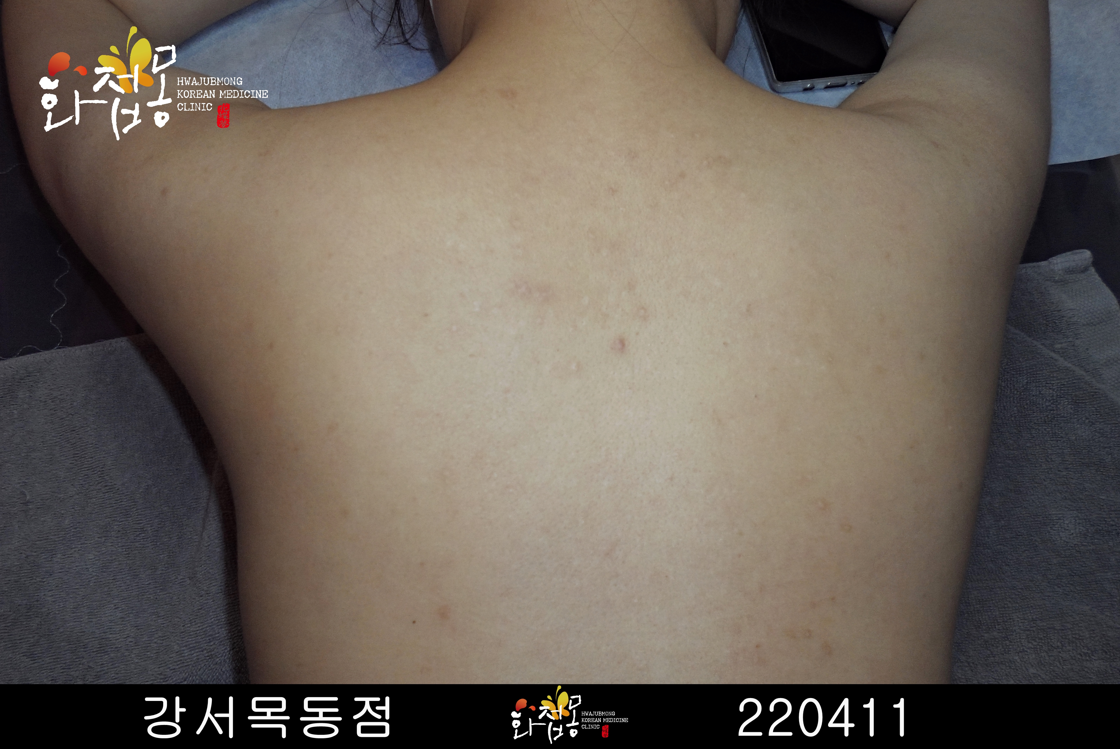 전후사진