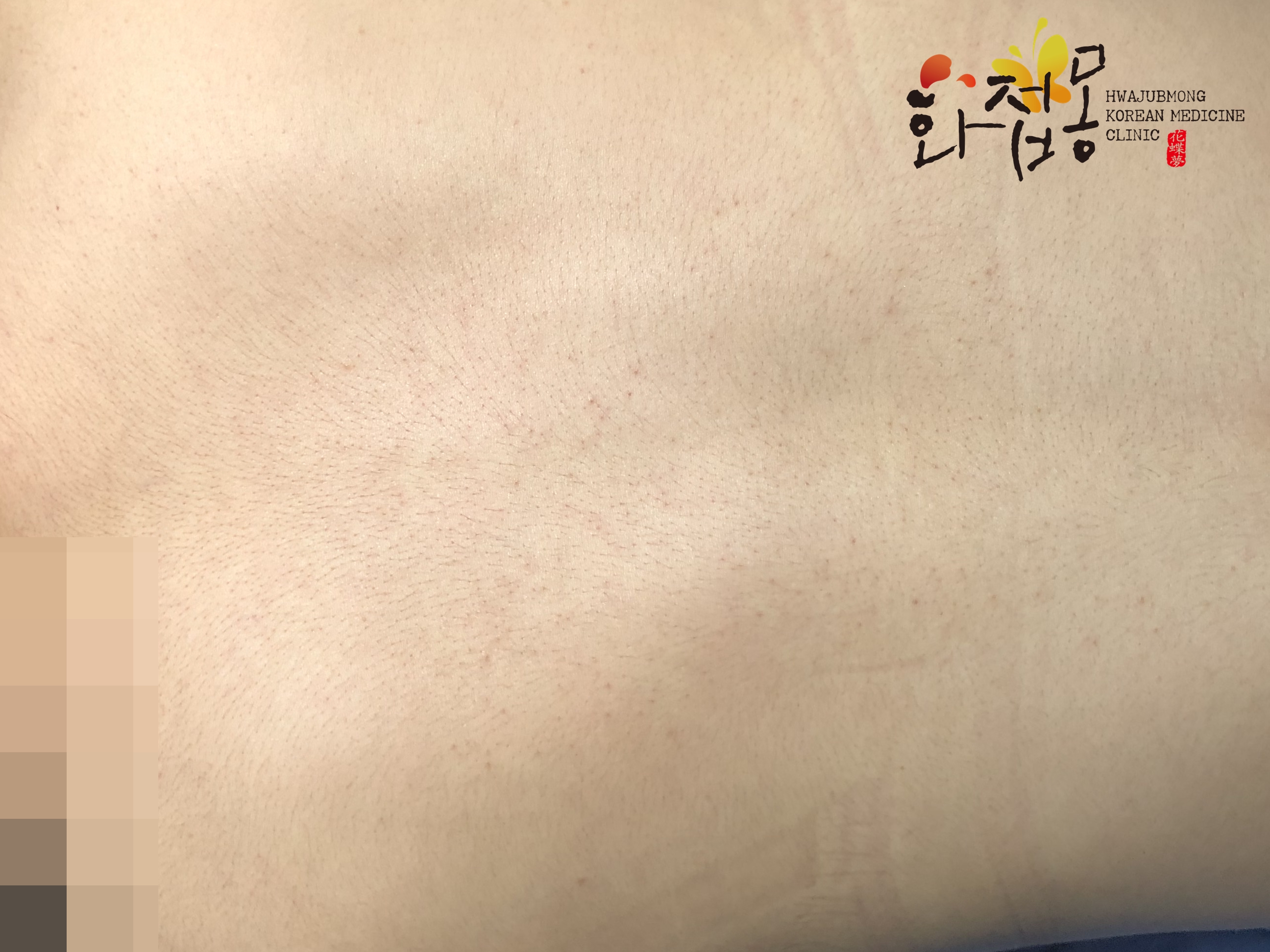 전후사진