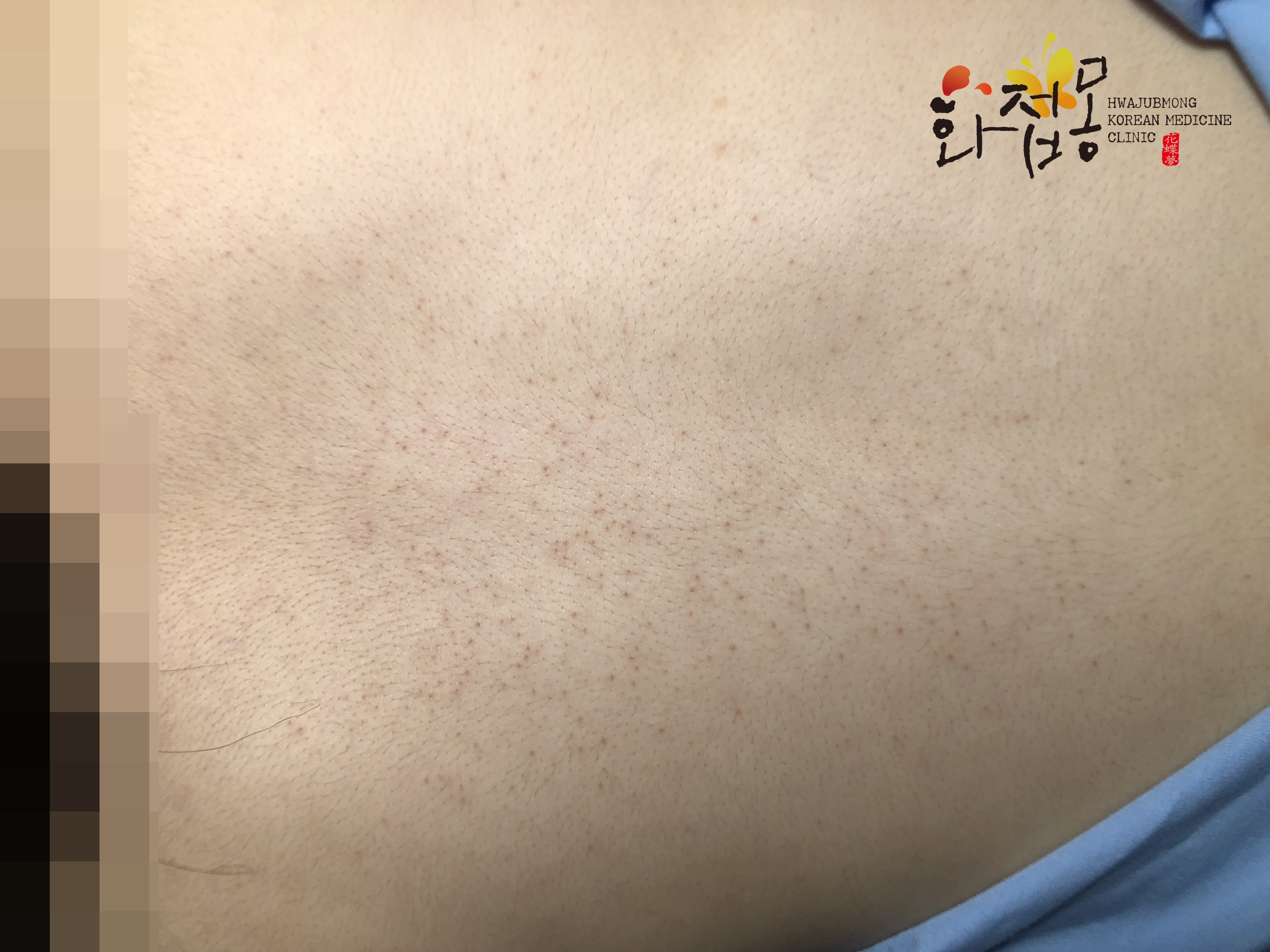 전후사진