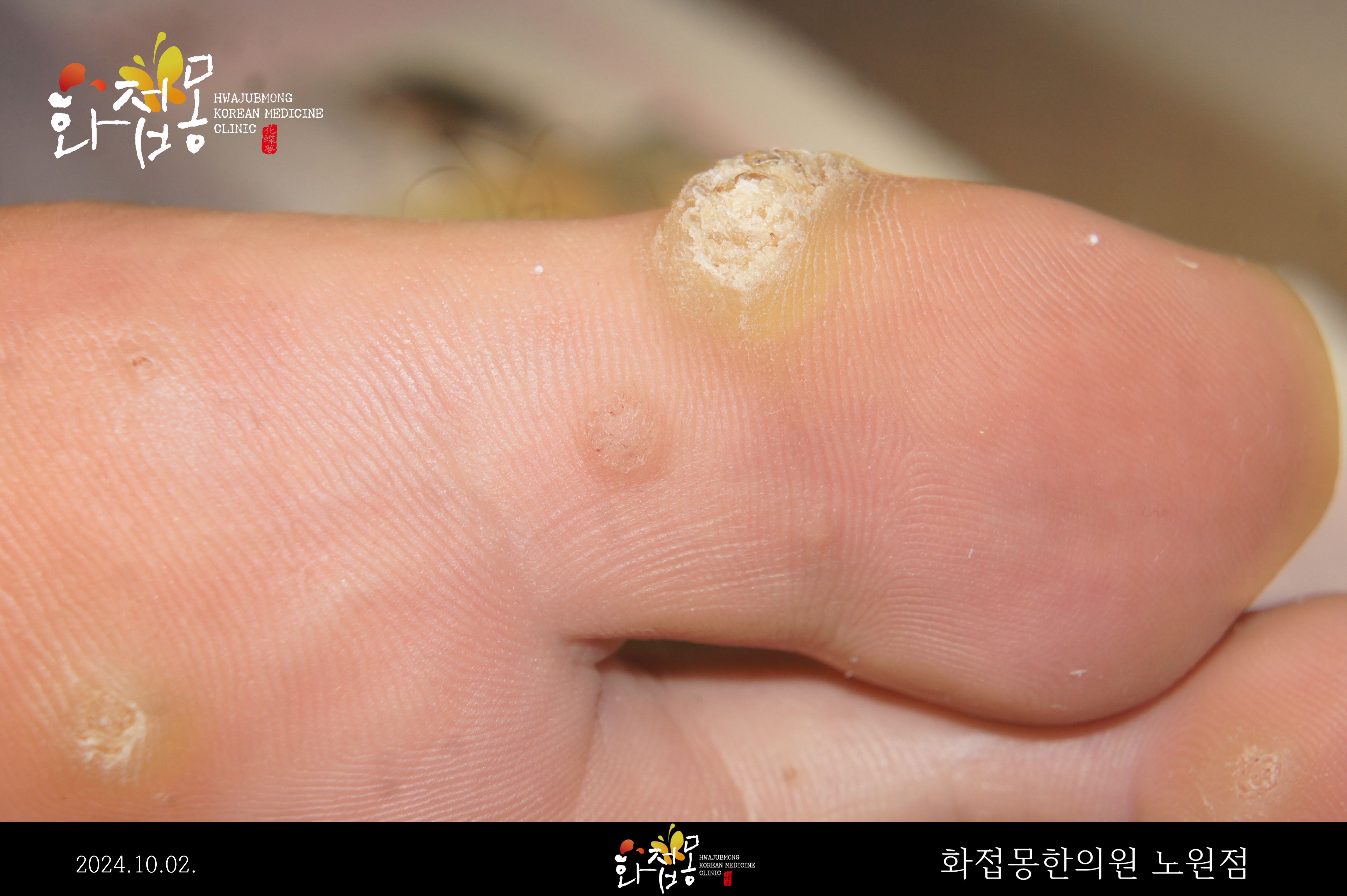 전후사진