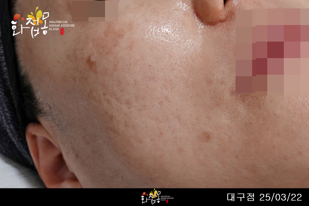 전후사진