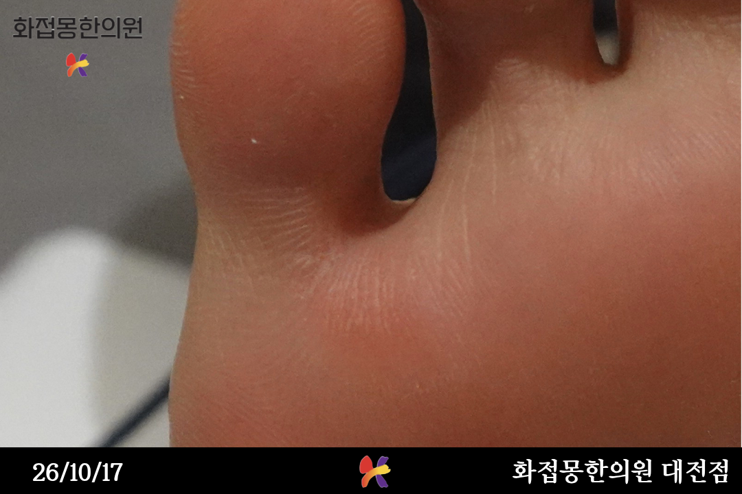 전후사진