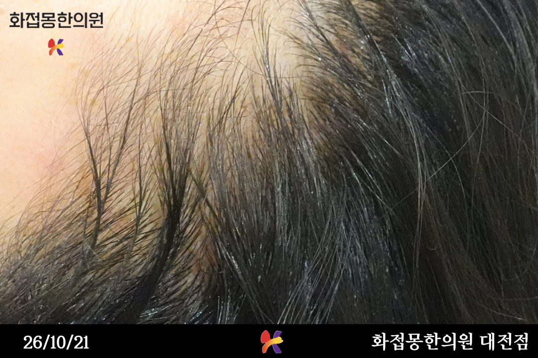 전후사진