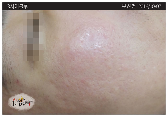 전후사진