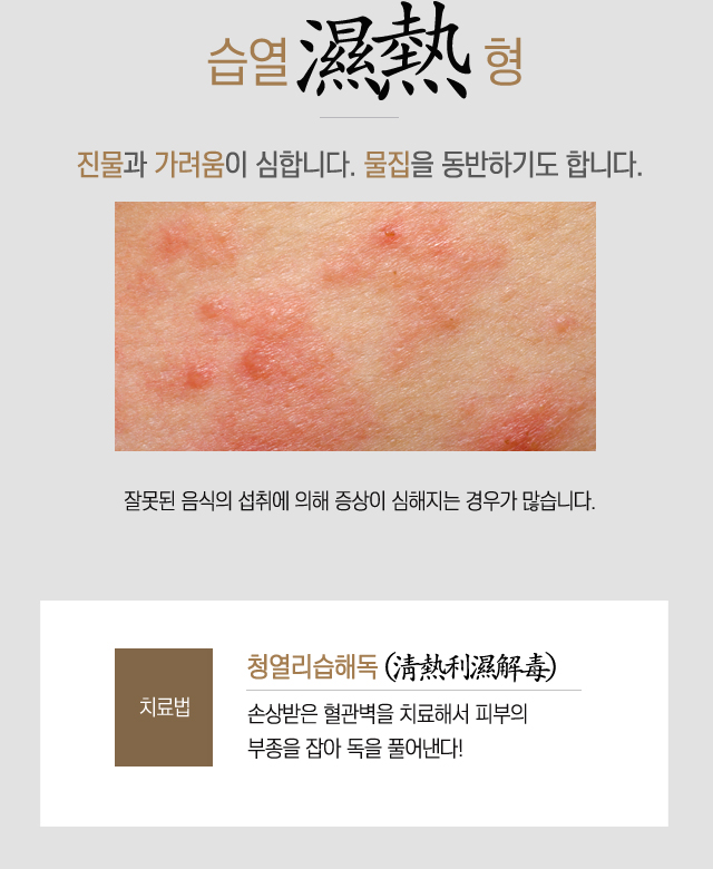 치료단계2