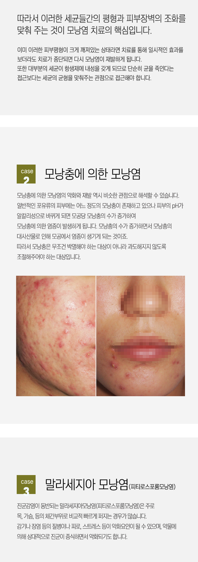 모낭염