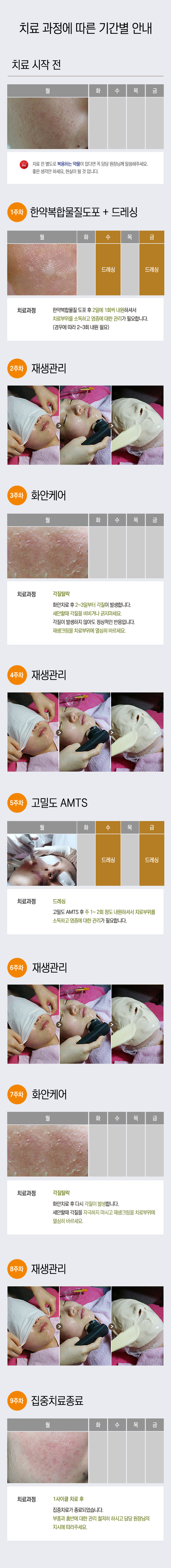 여드름흉터
