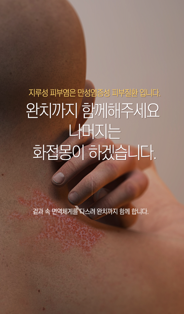 지루성피부염