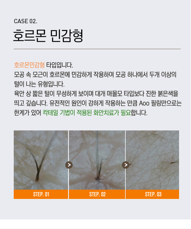 모공각화증